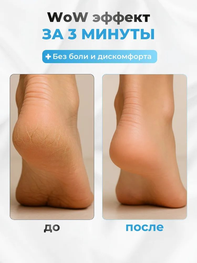 Пемза для пяток / Терка для ног / Нано пемза для ног, вариант, фото 3