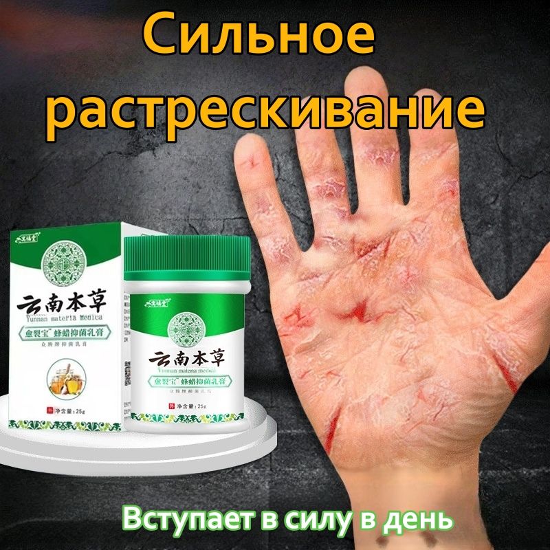 Мазьдлялечениятрещиннаруках