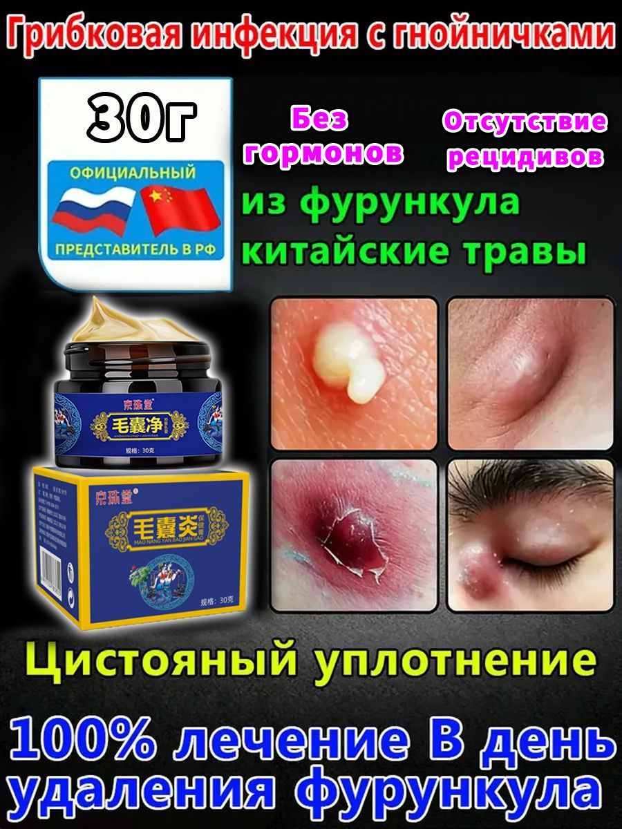 Вытягивающийпластырьотфурункулов,акнеигнойников