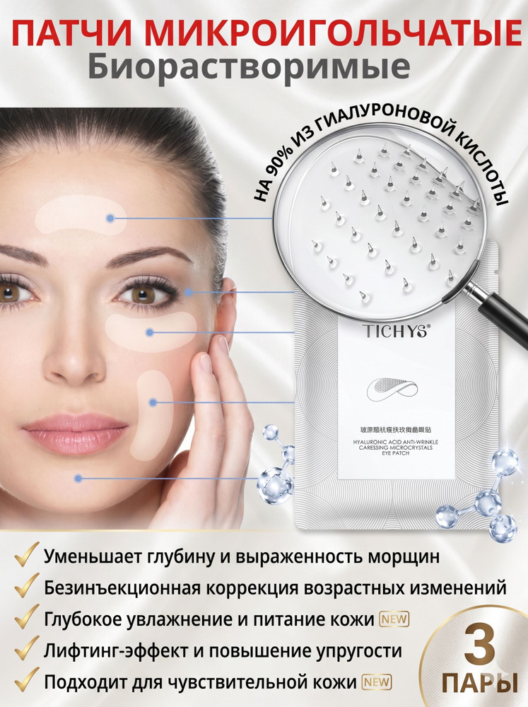 Патчи #1