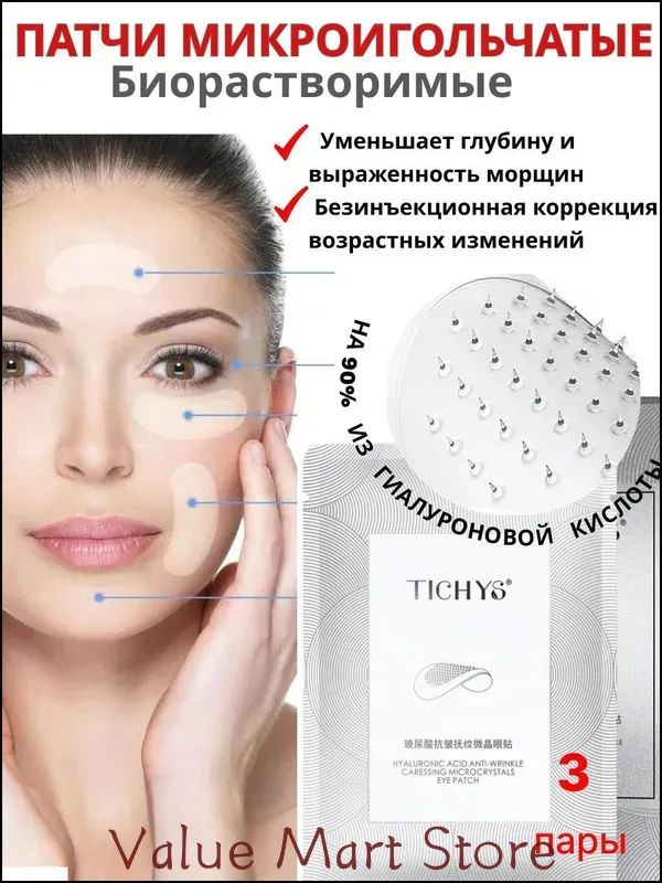 Патчи. #1