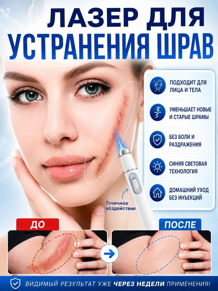 Пилинг #1