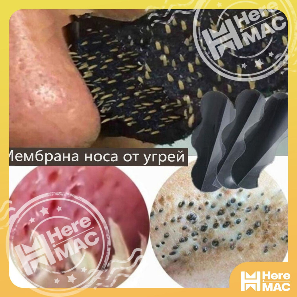 Патчи #1