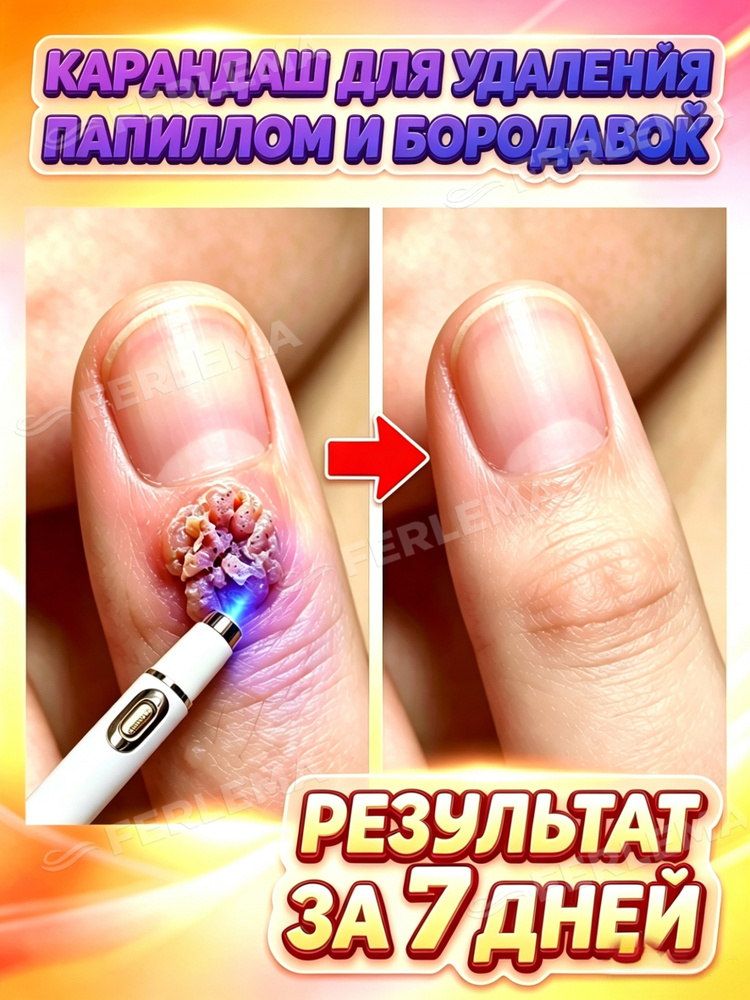 Пилинг #1