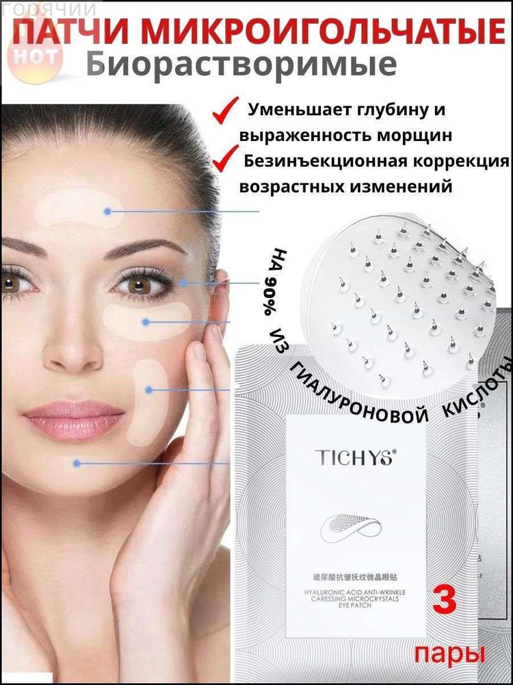 Патчи #1