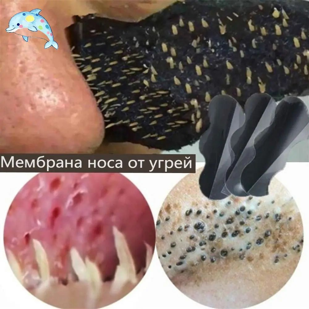 Патчи #1