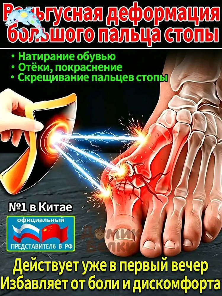 Патчи #1