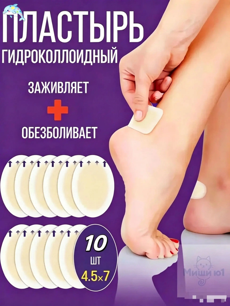 Патчи #1