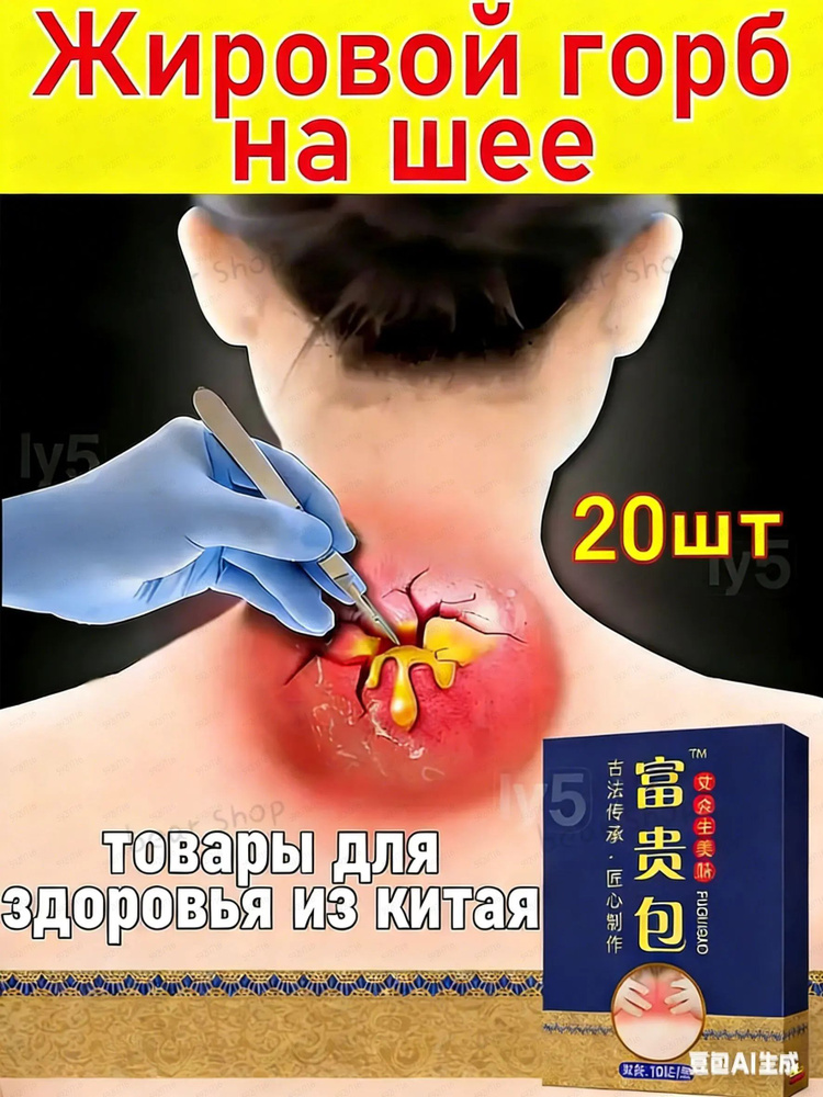 Патчи #1