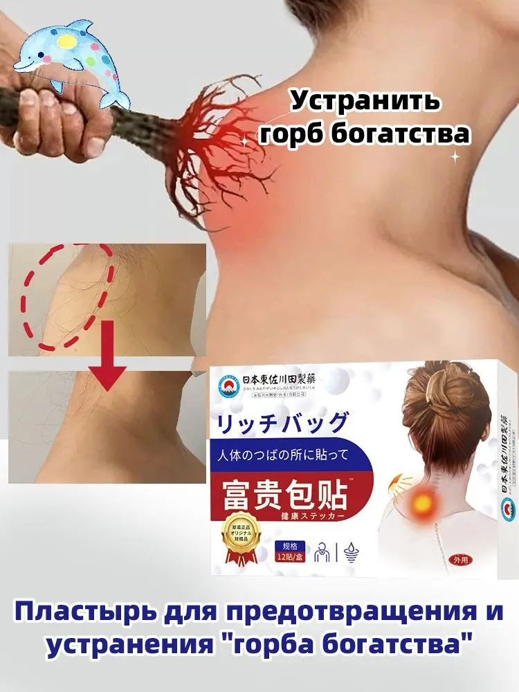 Патчи #1