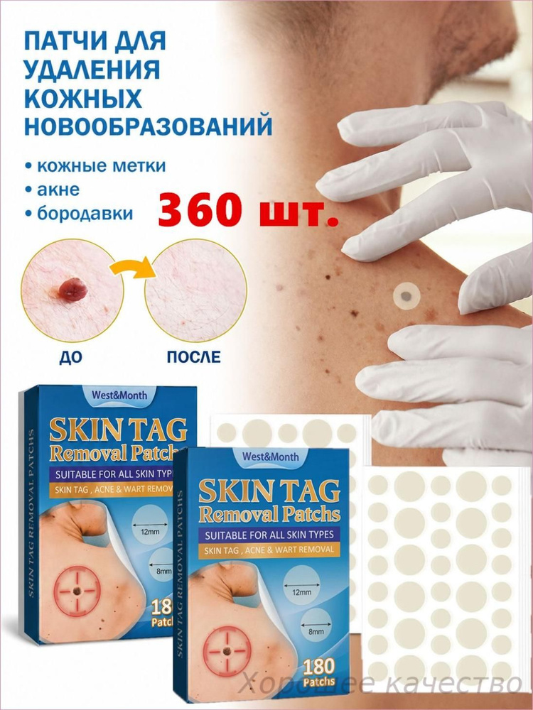 Патчи #1