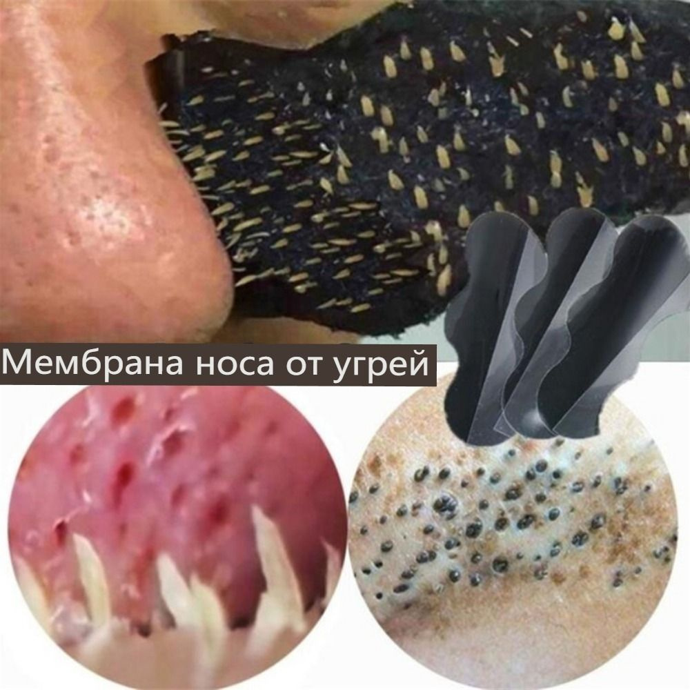 Патчи #1