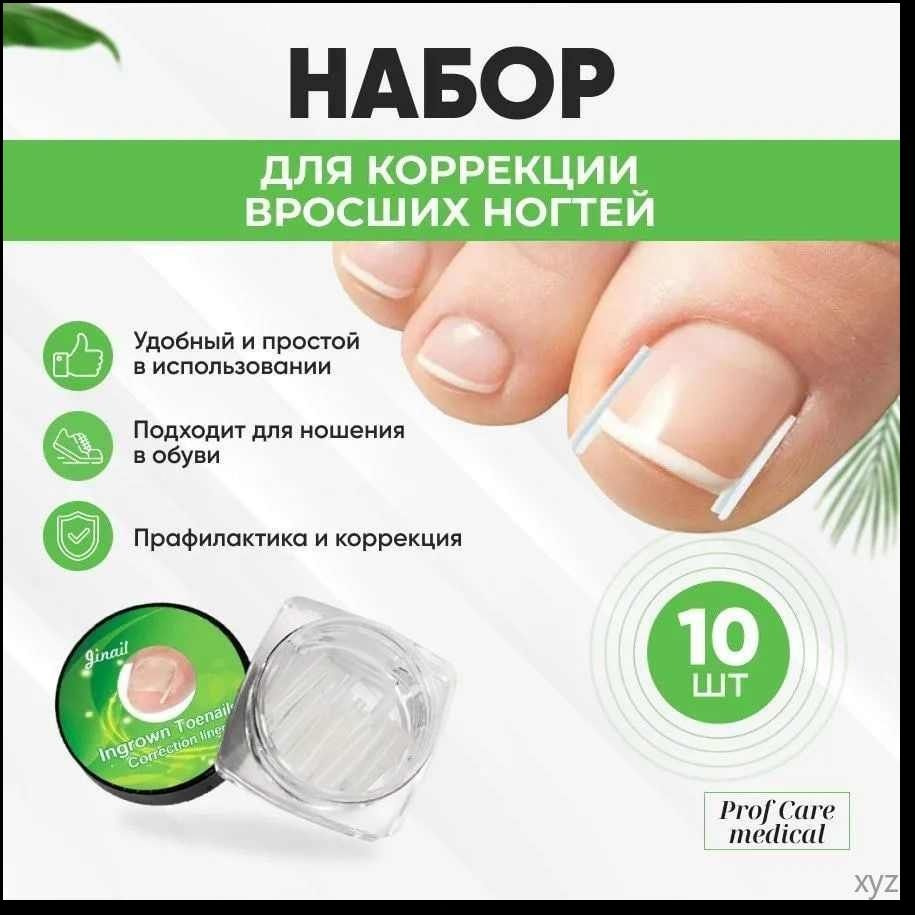 Корректор стопы #1