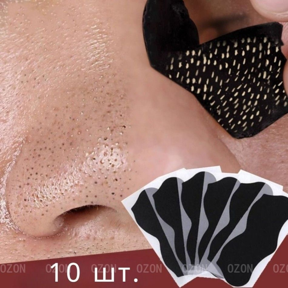 Патчи #1
