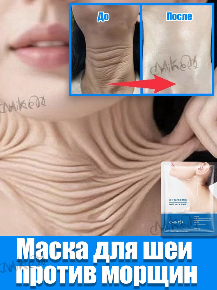 Патчи #1