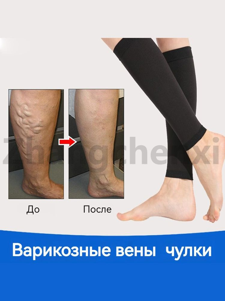Гетры #1