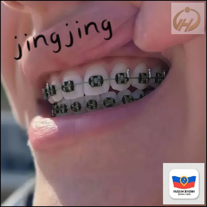 Грилзы #1