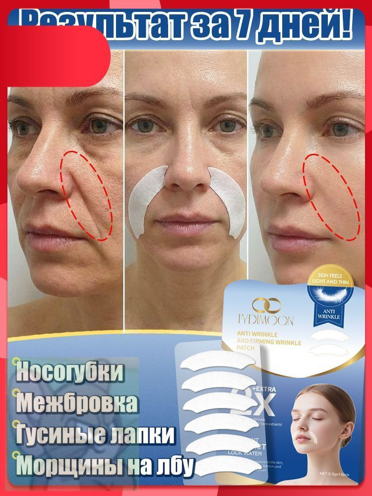 Патчи #1