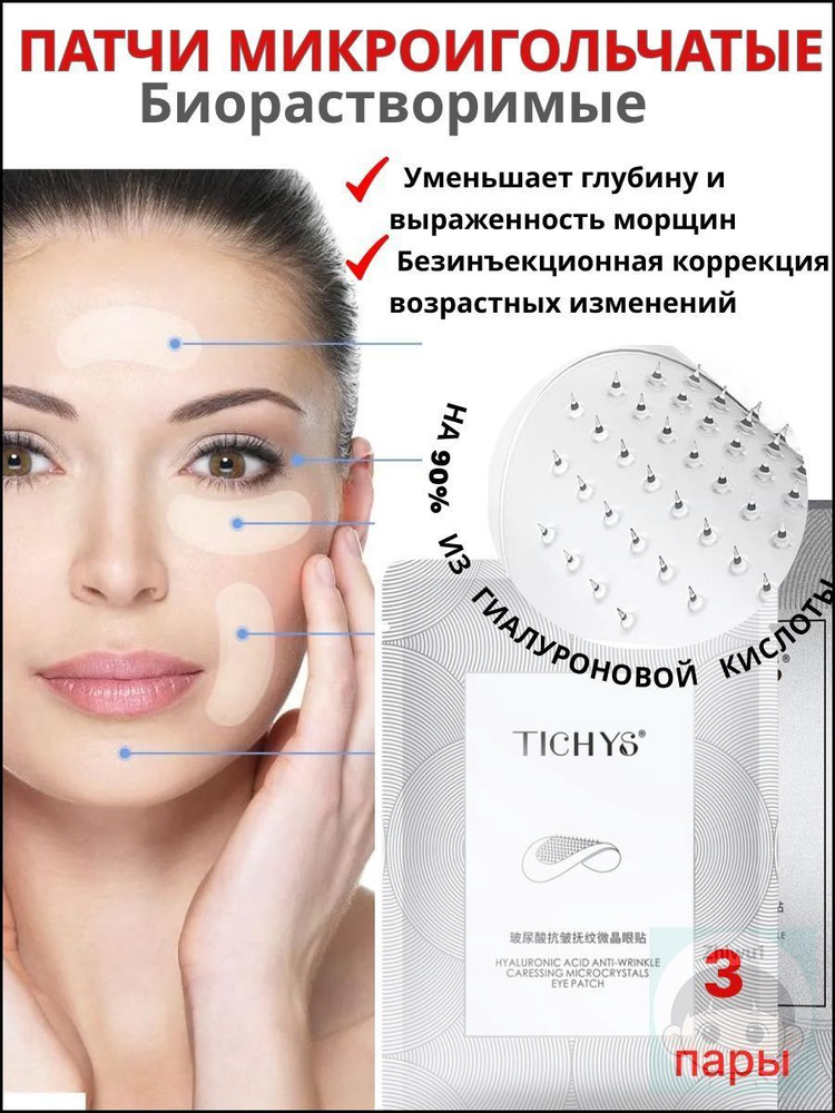 Патчи #1