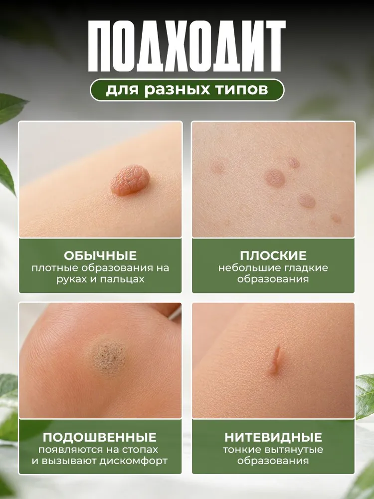 Чистотел от папиллом и бородавок, гель от папиллом, от натоптышей, от мозолей, вариант, фото 5