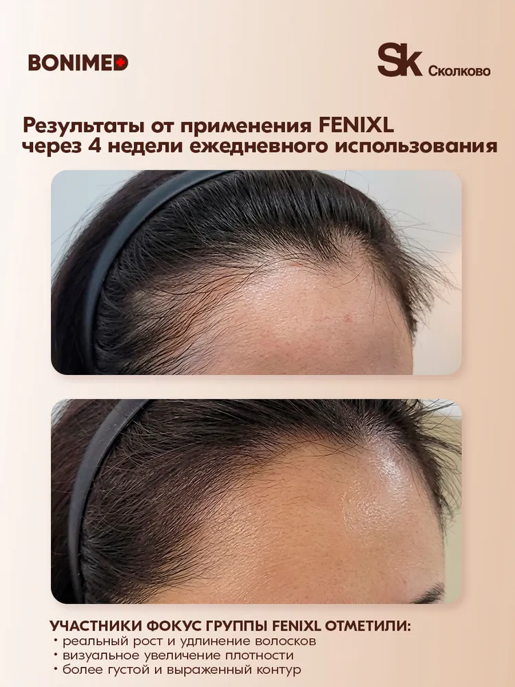 BONIMED FENIXL сыворотка против выпадения и для роста волос, активатор роста, спрей 100 мл, 100 мл, фото 2