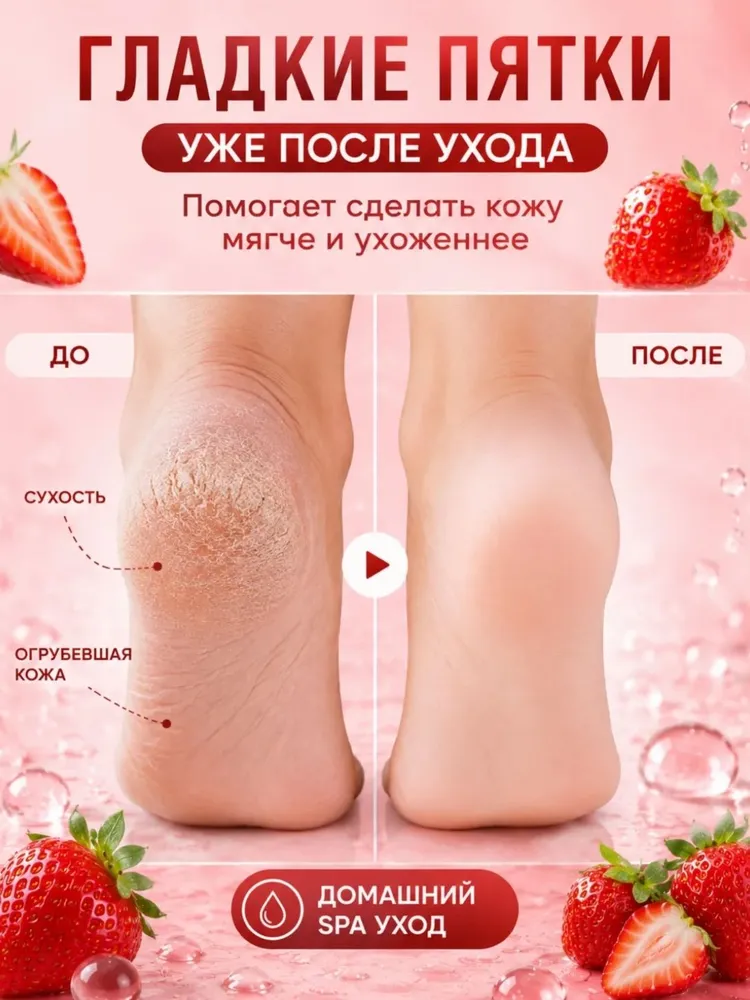 Носочки для педикюра с экстрактом клубники , 5 штук, вариант, фото 2