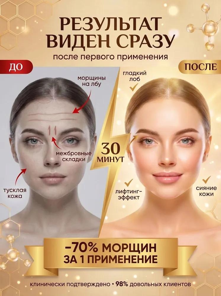 Патчи для лица от морщин на лбу и межбровья, тейпы косметические омолаживающие, 10 шт A.K.S, 20 шт, фото 2