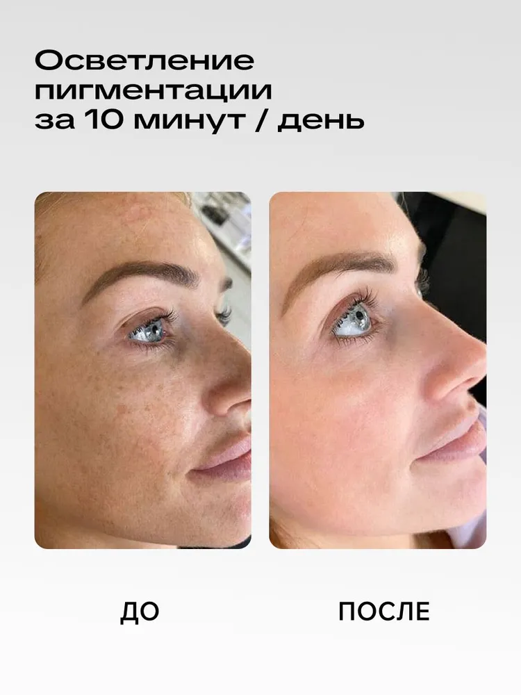 Светодиодная LED маска для фототерапии лица TIMFATO LUMA MP-2308, вариант, фото 3