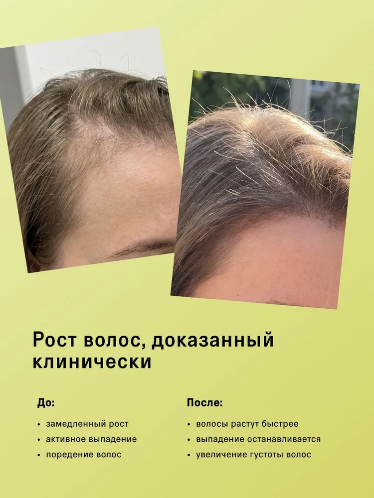 The Act Сыворотка для роста волос от выпдения BALANCE, 50 мл, 50 мл, фото 4