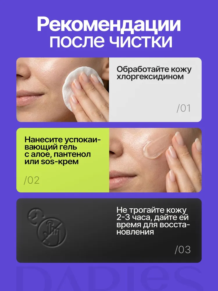 Набор косметологических инструментов для чистки лица от черных точек, акне и от прыщей на лице, черный, фото 6