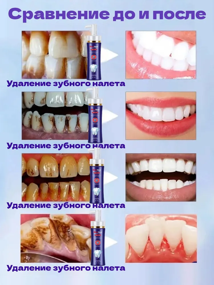 Отбеливающая зубная паста 150 г с молочнокислыми бактериями, энзимная, от камня и налета, укрепляет эмаль, защищает от кариеса, 150 г, фото 4
