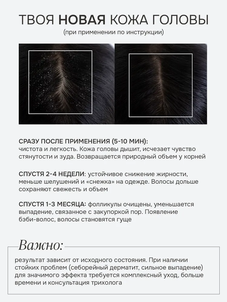 PER SAINT RITUALS Пилинг для кожи головы очищающий против перхоти для роста волос от жирности с розмарином, 100 мл, 100 мл, фото 2