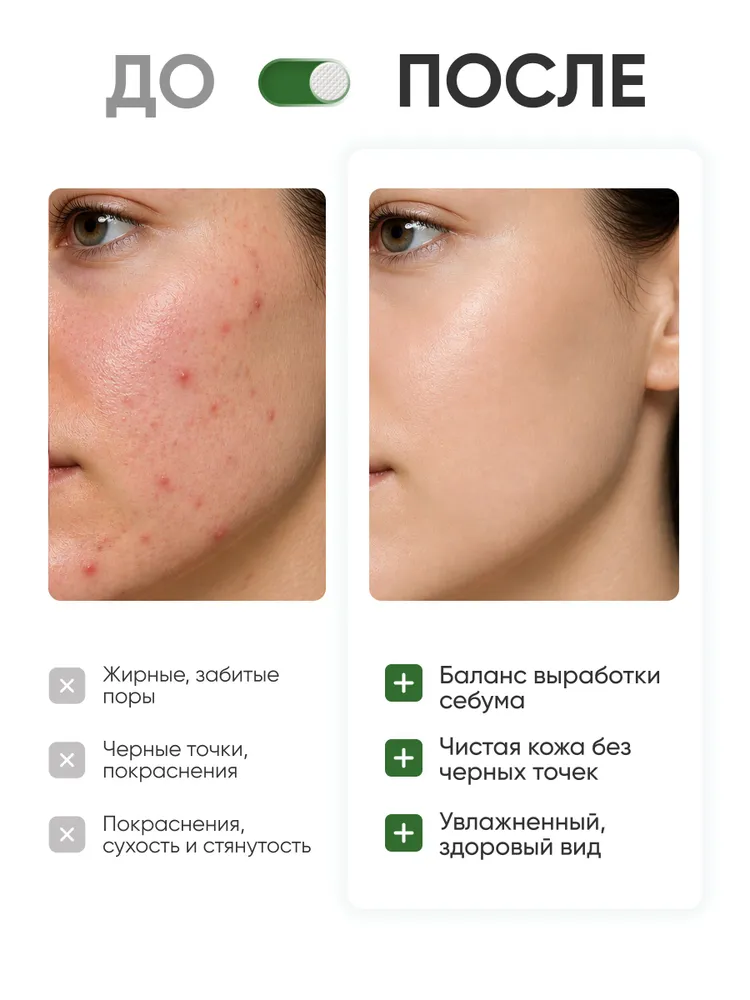 ANUA Сыворотка с азелаиновой кислотой / Anua Azelaic Acid 10 Hyaluron Redness Soothing Serum, вариант, фото 5