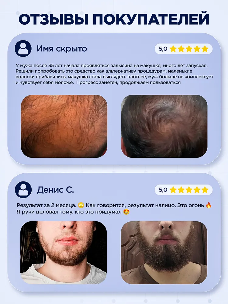 Лосьон сыворотка бустер 15% для роста бороды с мезороллером Vikinord, 15, фото 6