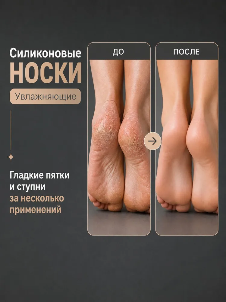 Силиконовые носочки многоразовые от мозолей, SPA носки для педикюра, вариант, фото 4