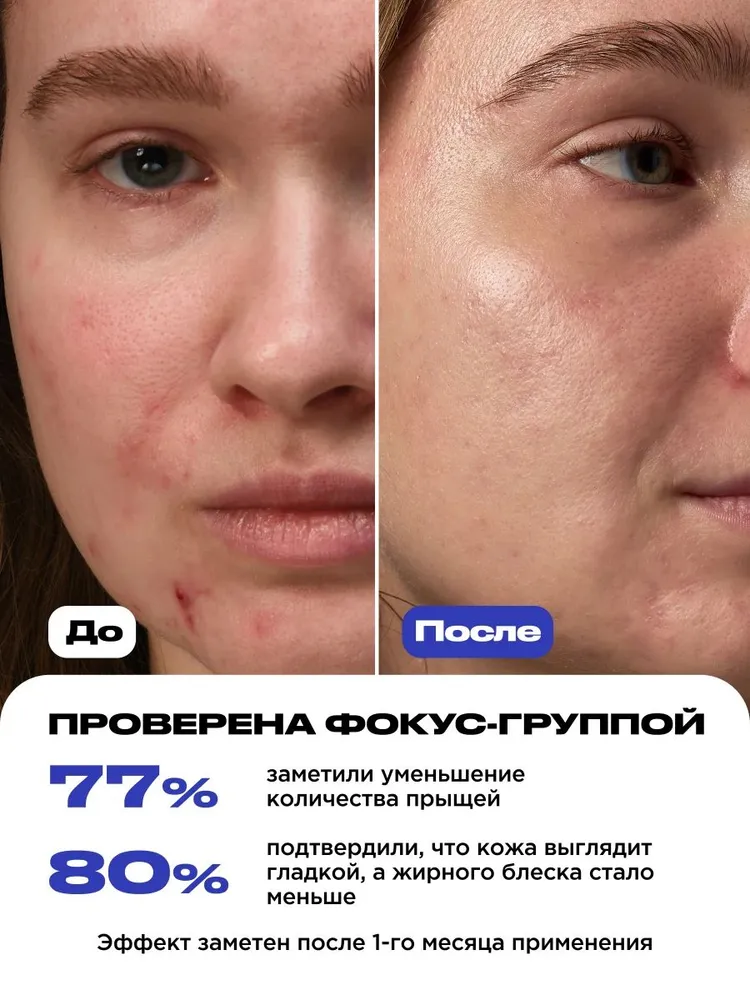 VOIS Сыворотка для лица с салициловой кислотой и ниацинамидом от прыщей, вариант, фото 2