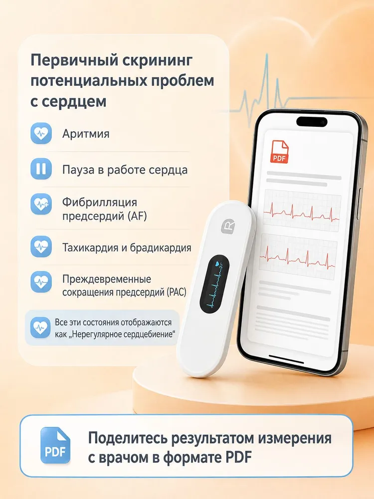 Wellue Кардиомонитор, белый, белый, фото 4