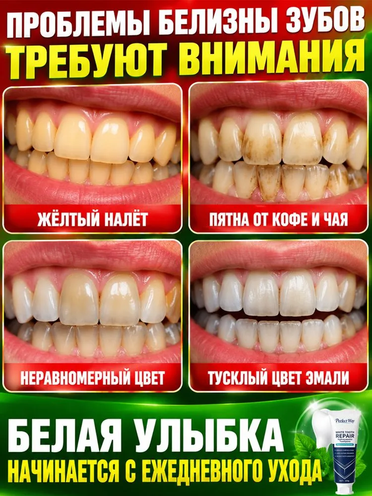 Эта зубная паста удаляет зубной налет, предотвращает кариес, восстанавливает зубную эмаль, очищает поверхность зубов и отбеливает их. 60 г/флакон, 100 г, фото 2