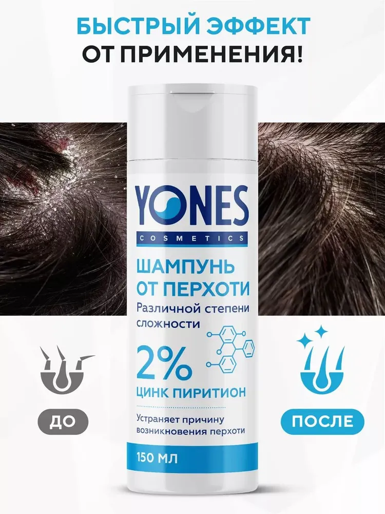 Yones шампунь от перхоти c цинком пиритионом 2%, против себореи, псориаза, 150 мл, 150 мл, фото 3