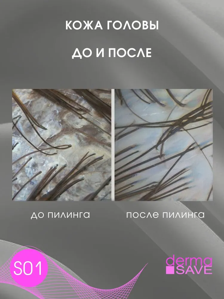 DERMASAVE Преш гель S01 Пилинг гель с гиалуроном для кожи головы Hyaluron SPA PRO Peeling gel , 200 мл, 200 мл, фото 3