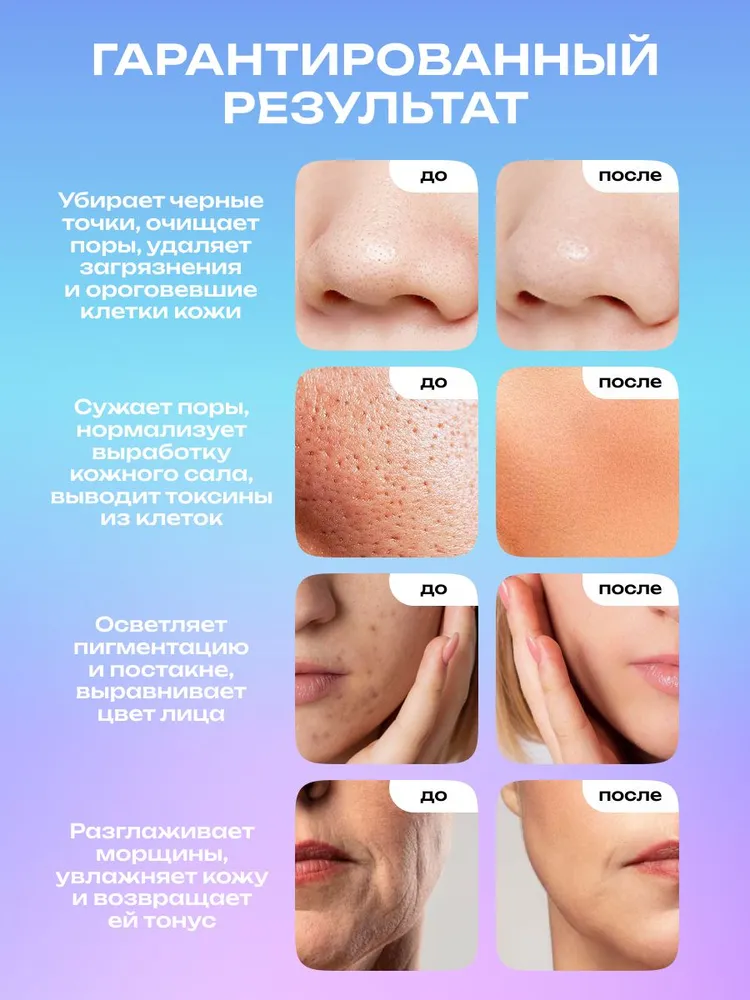 Doctor Comfort Ультразвуковая чистка лица US-4, аппарат для уз чистки, лифтинга, питания и увлажнения кожи, скрабер, вариант, фото 3