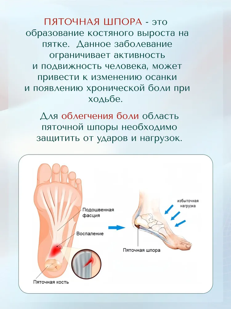Подпяточники MyBalance при пяточной шпоре, напяточники с силиконовой вставкой от боли в пятке, вариант, фото 3