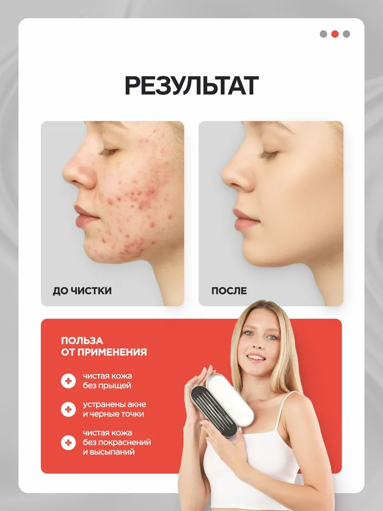 MEDKING Косметологический набор для чистки кожи лица и пор, инструменты для выдавливания прыщей чёрных точек угрей акне, давилка, Ложка УНО / Серебристые 4шт., 6 шт, фото 5