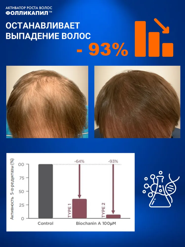Фолликапил активатор роста волос негормональная сыворотка с капиксилом от выпадения для женщин и мужчин, 250 мл, 250 мл, фото 5