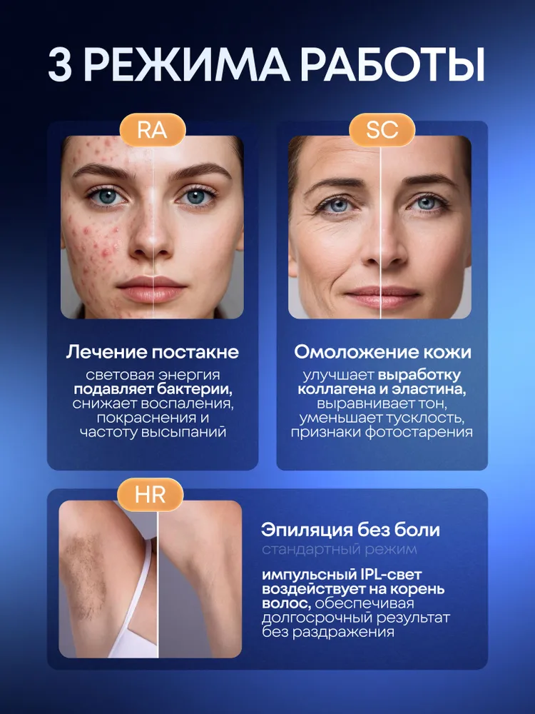 Фотоэпилятор для удаления волос женский, вариант, фото 6
