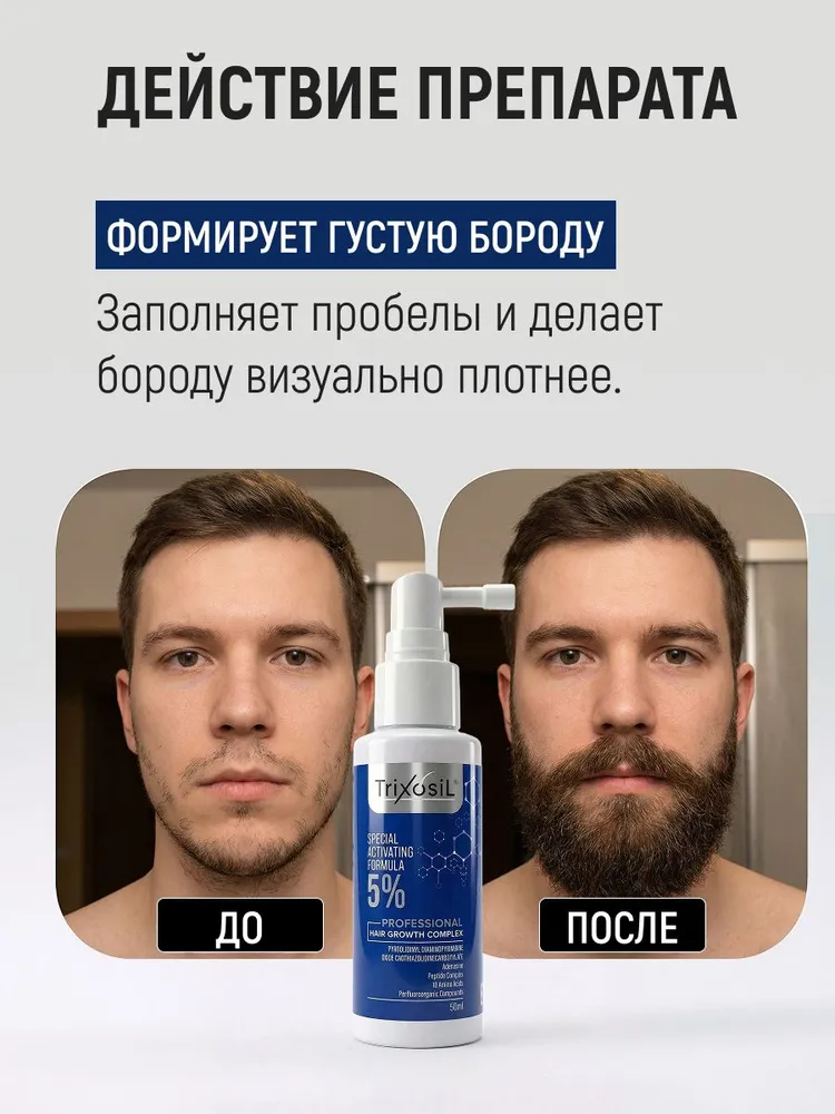 Trixosil 5% усиленная сыворотка для роста волос и бороды от выпадения, лосьон-активатор + мезороллер с комплексом пептидов и аминокислот, средство от алопеции для мужчин и женщин, вариант, фото 2