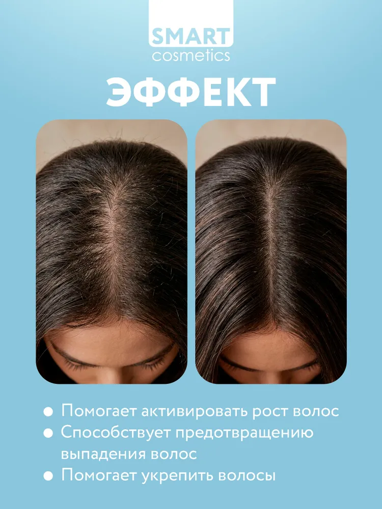 Магниевое масло для волос, 250 мл, SMARTNESIUM, 250 мл, фото 2