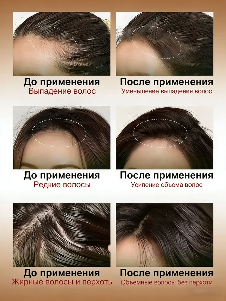 Шампунь против выпадения волос, 1 фолликул 4 волоса, +500% густоты, Профессиональный Шампунь против выпадения воло, Натуральный состав безопасный для беременных, 200 Мл, 200 мл, фото 5