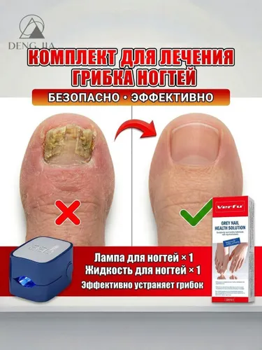 Синяя лампа от грибка ногтей на ногах 1 шт,Ручка для устранения грибка ногтей 1 шт