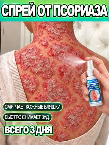Этот спрей/крем от дерматита лечит псориаз, дерматит, шелушение, экзему и покраснение. Он восстанавливает кожу и дает видимые результаты уже после первого распыления. Не содержит гормонов.30ml